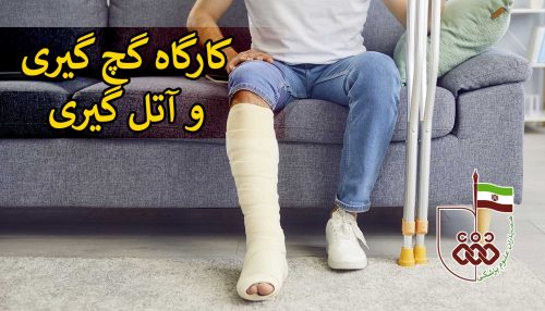 گچ گیری و آتل گیری