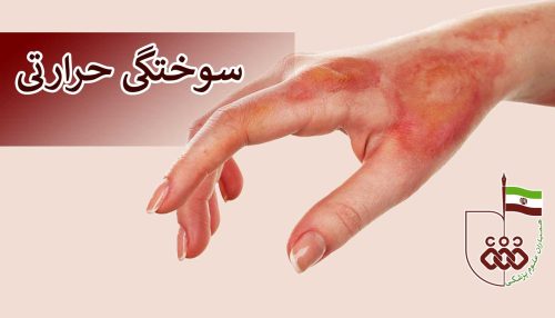 سوختگی حرارتی